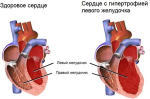 Как вода влияет на работу сердца?